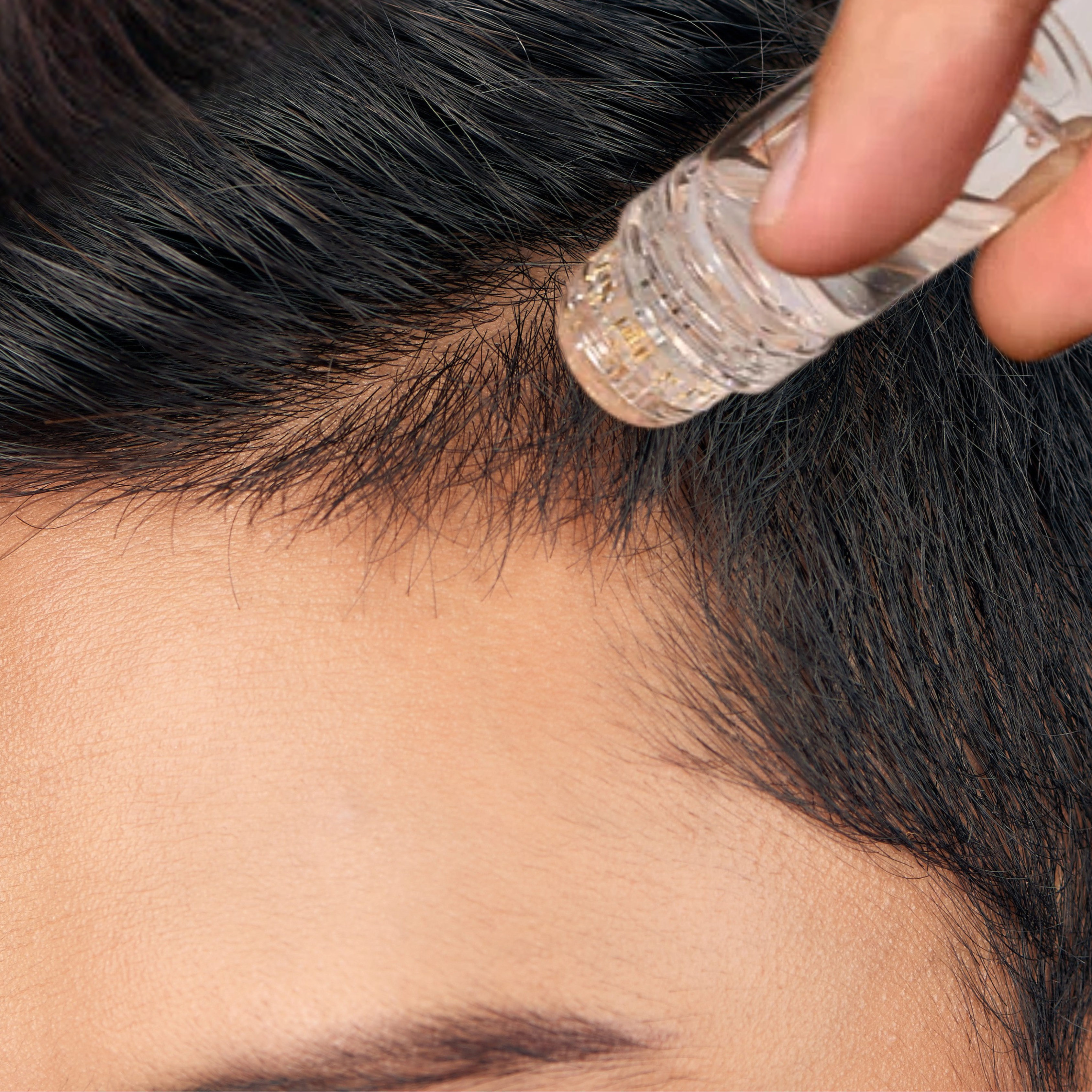 Follicly® Aplicador de sérum - agujas de titanio para microinfusión